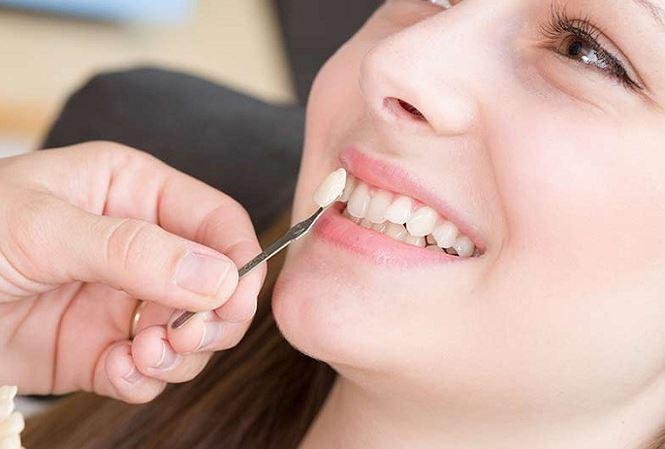 Nha khoa Việt Hưng cung cấp nhiều dịch vụ điều trị răng thẩm mỹ đa dạng