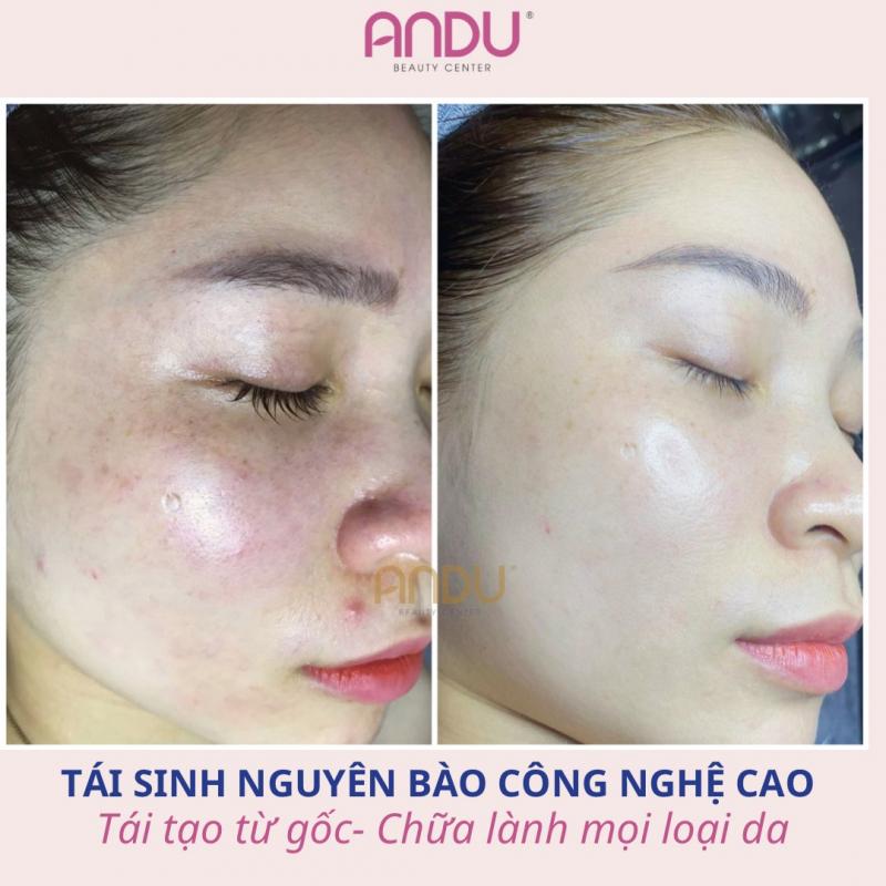 Andu Beauty & Spa-Hạ Long (ThanhChip Beauty)