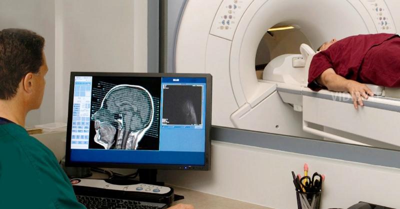 Chụp cộng hưởng từ MRI cho não
