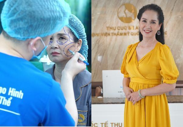 Cấy mỡ mặt tại Thu Cúc giúp nghẹ sĩ Việt trẻ ra 10 tuổi