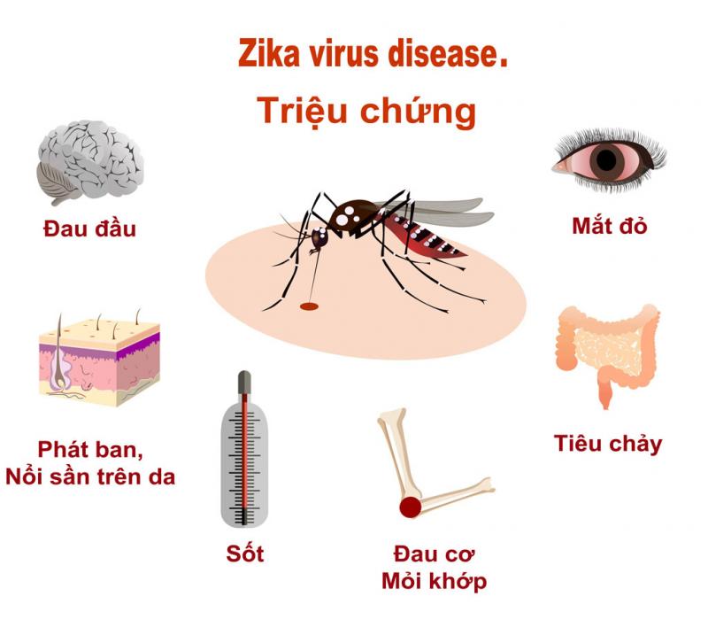 Các triệu chứng nhận biết bệnh virut Zika