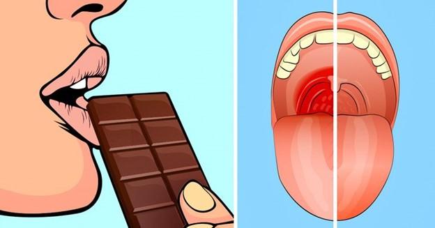 Ăn một miếng sô-cô-la đen để làm dịu cơn đau họng