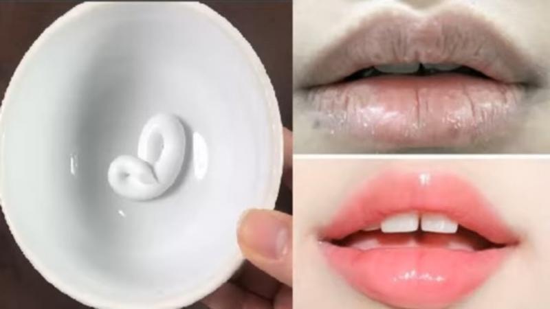 Trị thâm môi bằng kem đánh răng