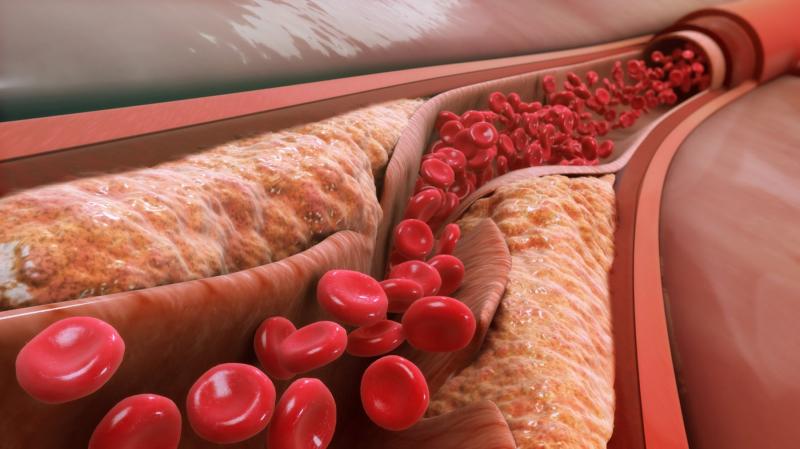 Sản phẩm chỉ định điều trị tăng cholesterol huyết (typ IIa)