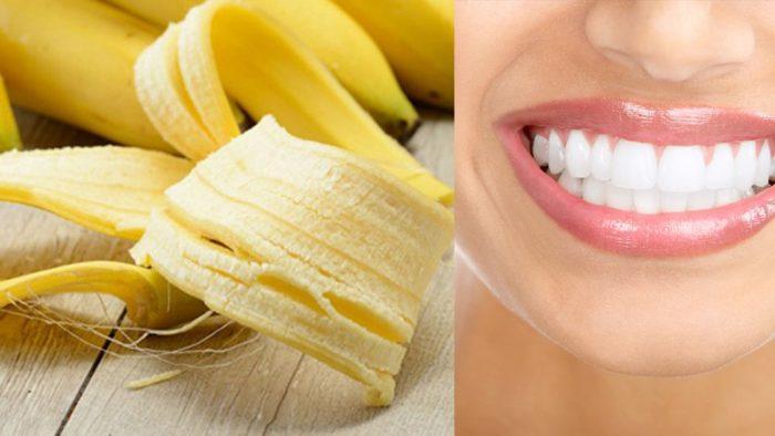 Một trong những bí kíp tẩy trắng răng hiệu quả tại nhà được nhiều người áp dụng chính là vỏ chuối.