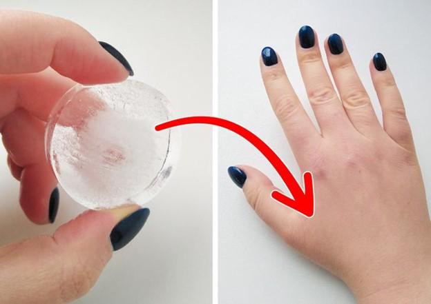 Đánh tan cơn đau răng bằng cách đặt một viên đá lên mu bàn tay giữa ngón trỏ và ngón cái của bạn