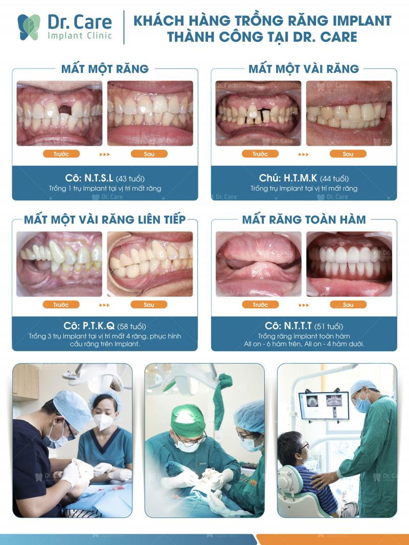 Dr. Care -  Implant Clinic: Nha khoa chuyên sâu trồng răng Implant dành riêng cho người trung niên tại Việt Nam.
