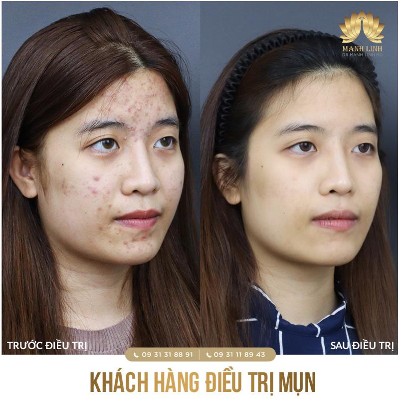 Dr Mạnh Linh MD