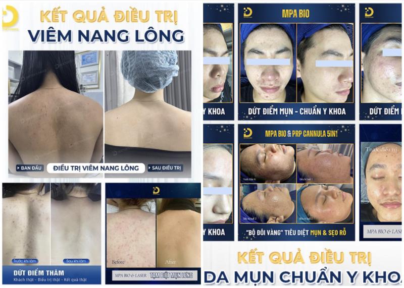 Dr.Choice Clinic – Chuyên trị mụn mặt và lưng uy tín ở TpHCM