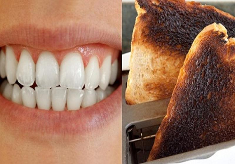 Bí quyết làm trắng răng hiệu quả nhất