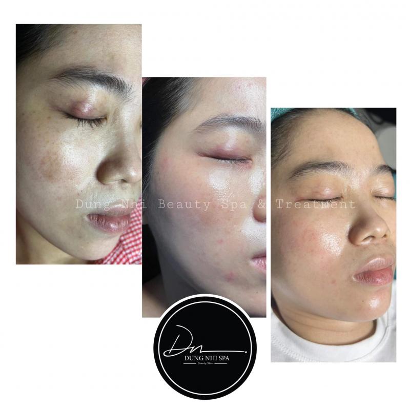 Dung Nhi Beauty Spa & Treatment