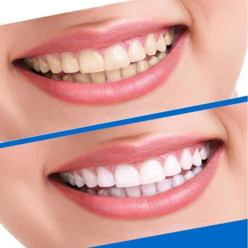 Miếng dán trắng răng Ckeyin 3D White Teeth Whitening Strips
