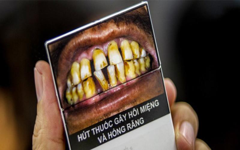Hút thuốc lá gây ố vàng răng và rụng răng