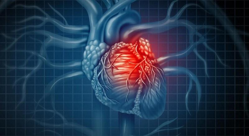 Tinh bột nghệ có tác dụng giảm nguy cơ bệnh tim