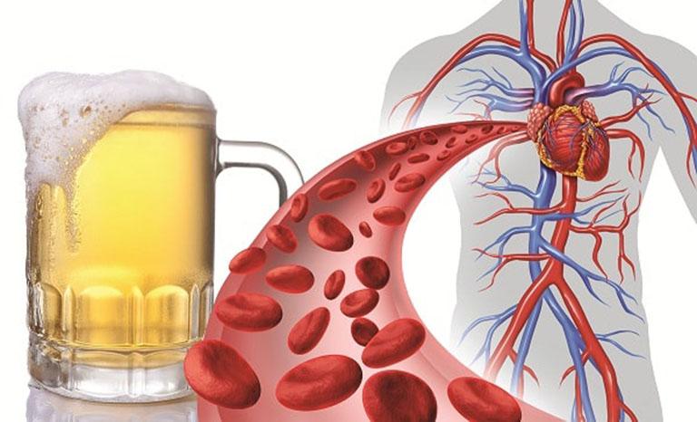 Hạn chế uống rượu, bia giúp hạ huyết áp