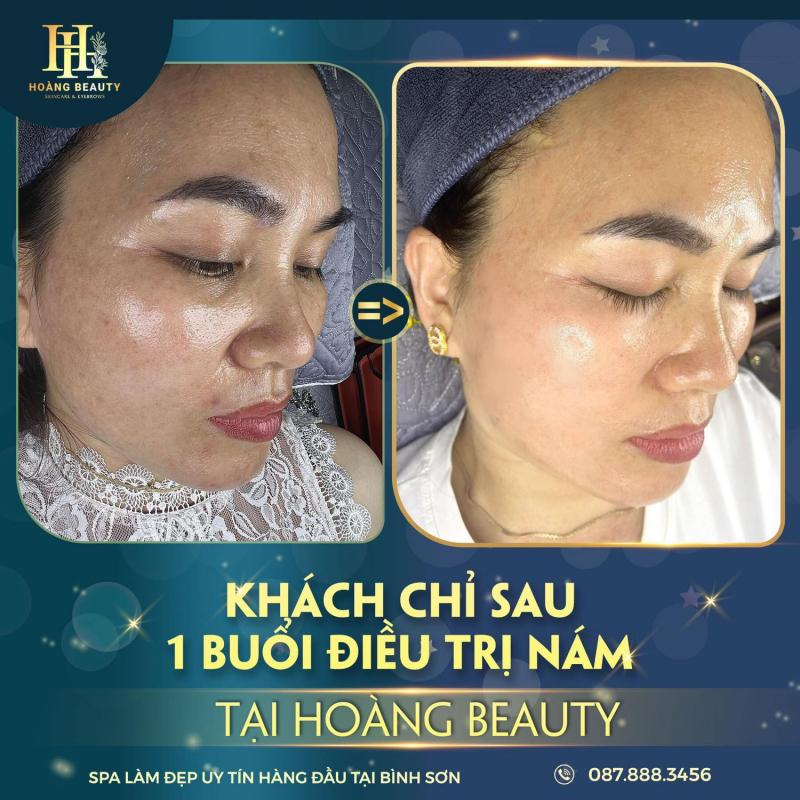Hoàng Beauty & Spa - Chi Nhánh Quảng Ngãi