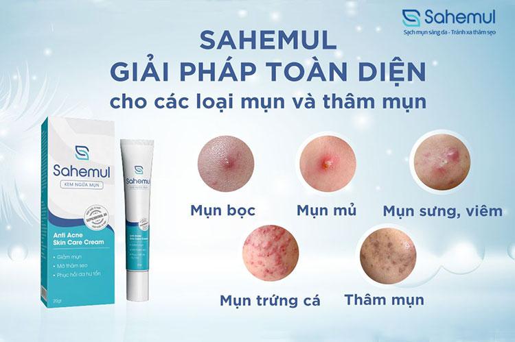 Kem ngừa mụn Sahemul – Anti Acne Skin Care Cream