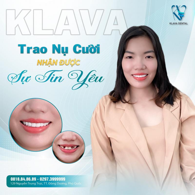 Klava Smart Dental