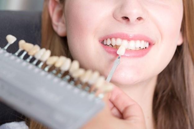 Làm thế nào để răng trắng sáng hơn ?