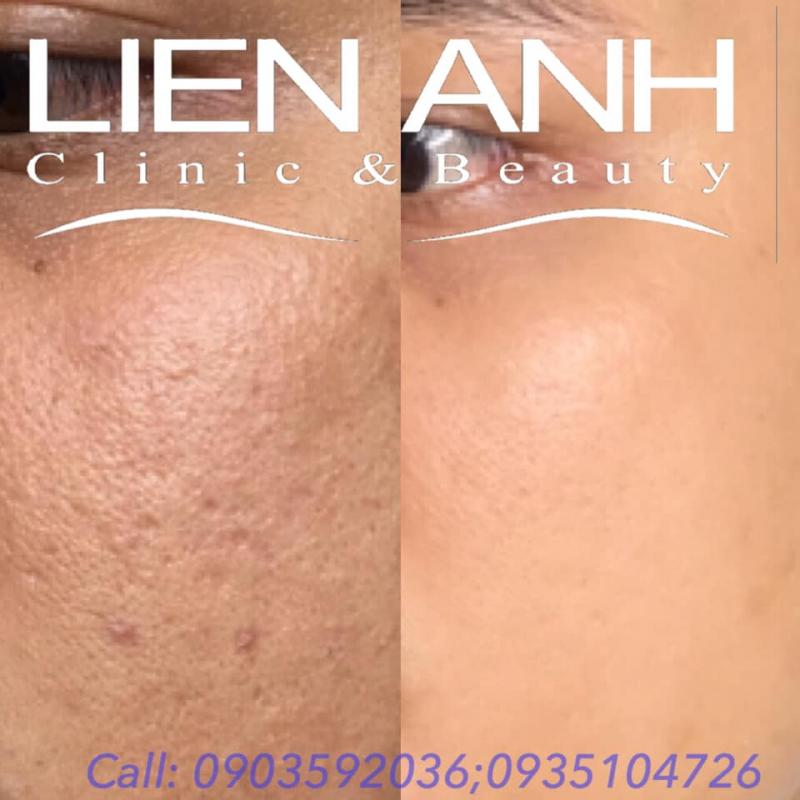 Lien Anh Clinic and Beauty