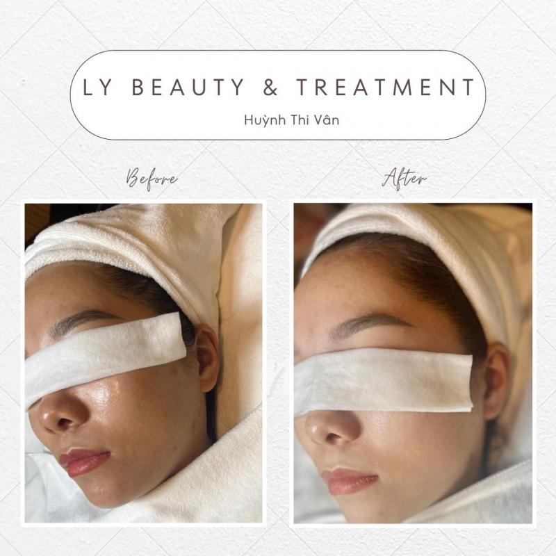 Ly Beauty & Treatment