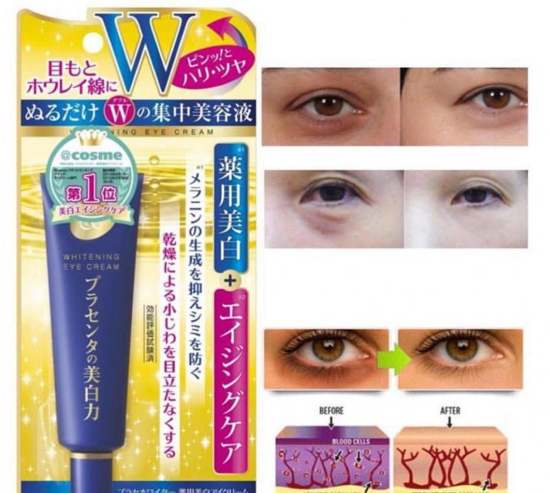 Kem dưỡng mắt Meishoku Whitening Eye Cream