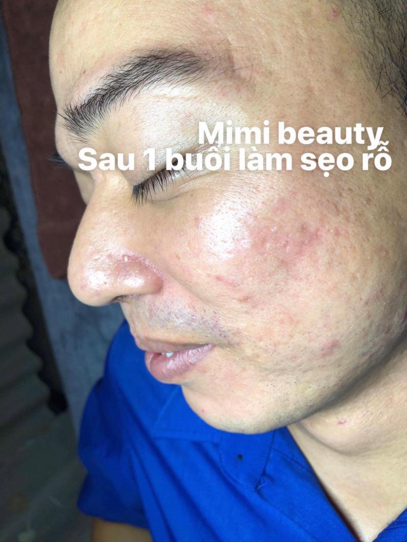 MiMi Beauty & Clinic - Nha Trang
