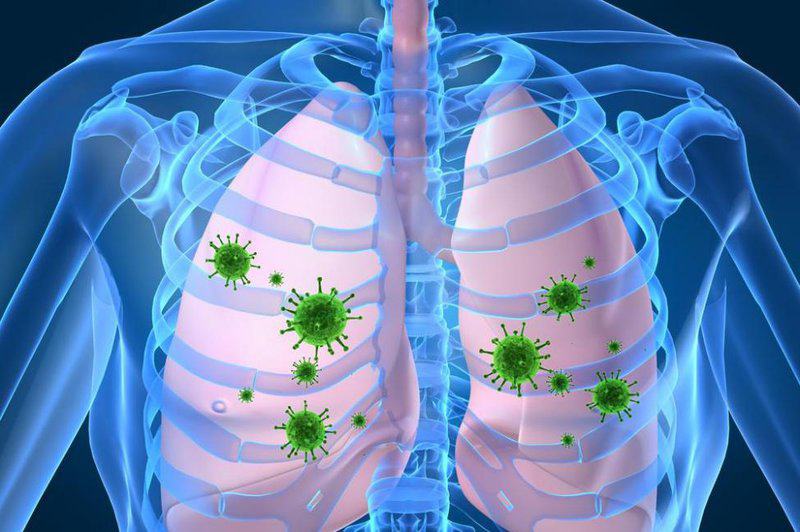 Nhiễm virus - nguyên nhân phổ biến nhất của viêm màng phổi