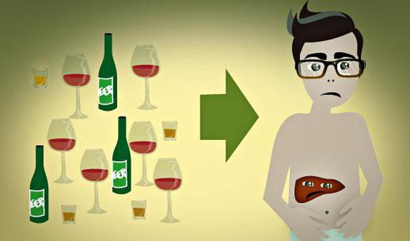 Sử dụng rượu bia thường xuyên khiến tế bào gan bị tổn thương
