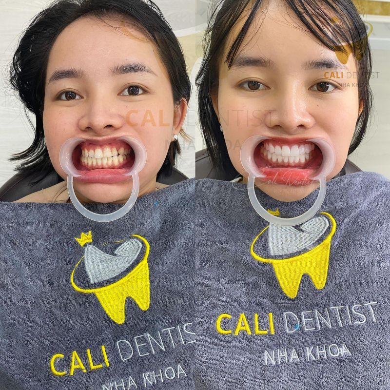 Nha khoa Cali Dentist