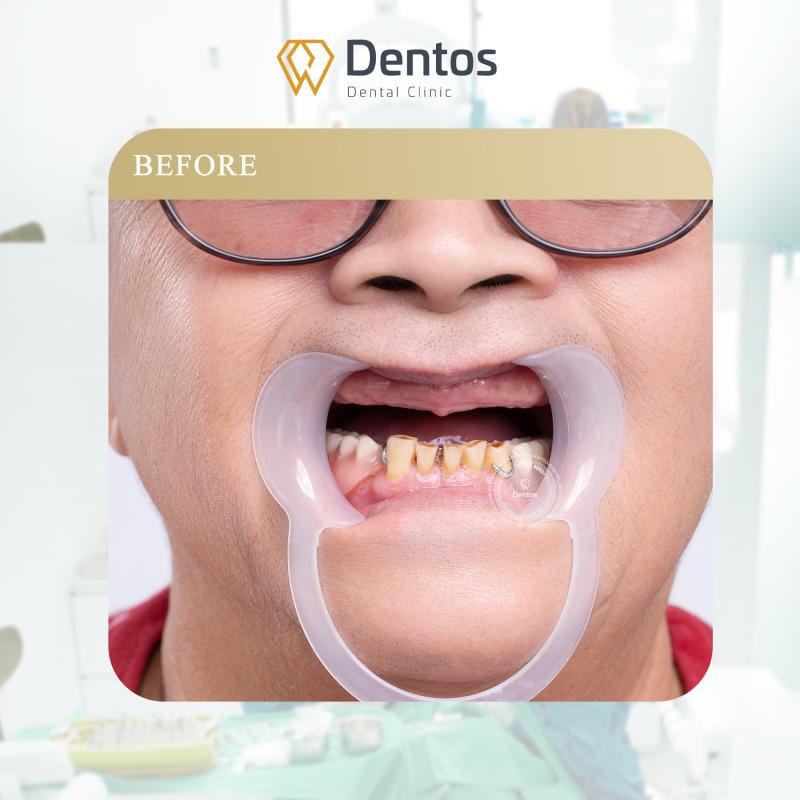 Nha khoa Dentos