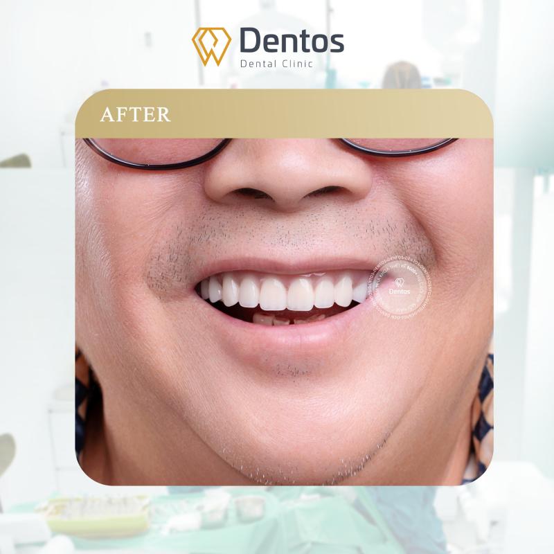 Nha khoa Dentos