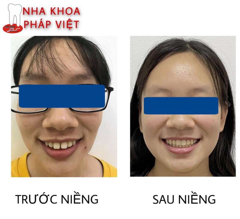 Nha khoa Pháp Việt Huế