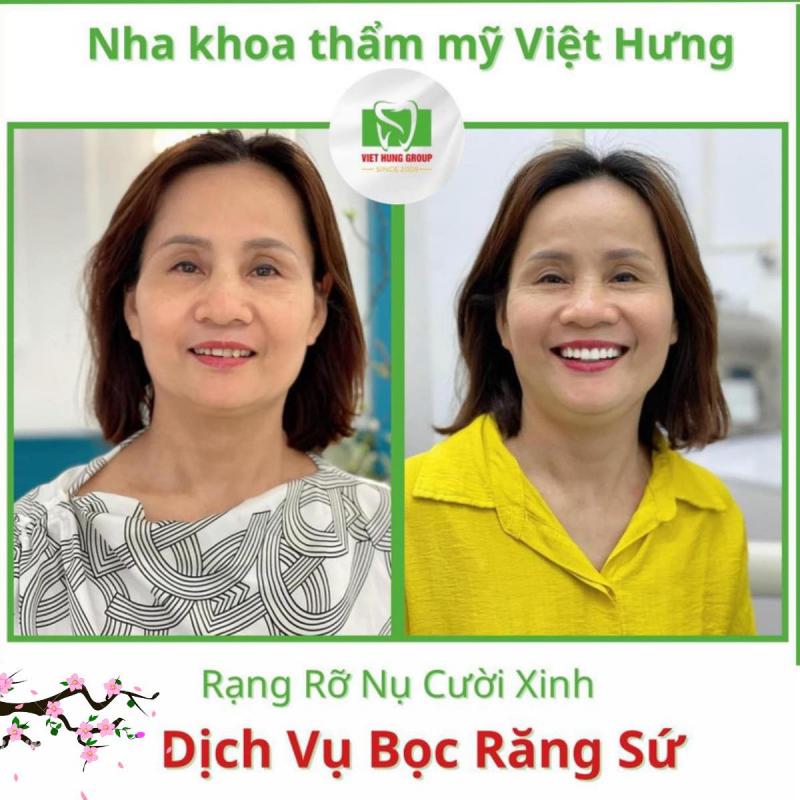Nha khoa Quốc tế Việt Hưng
