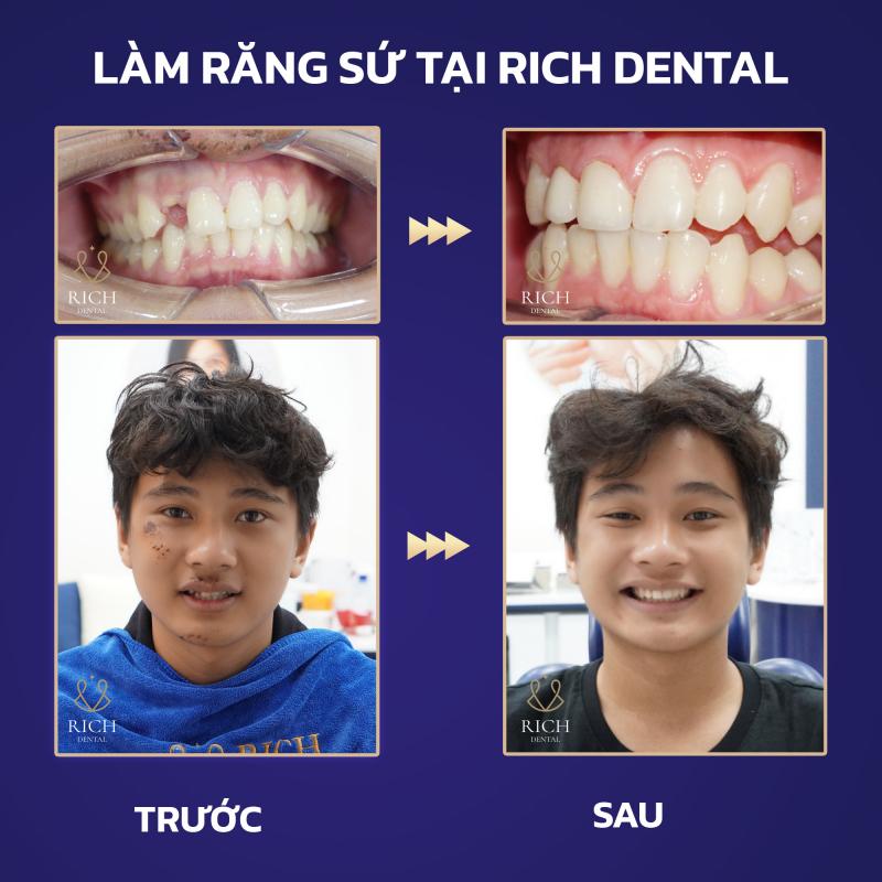 Nha Khoa Rich Dental