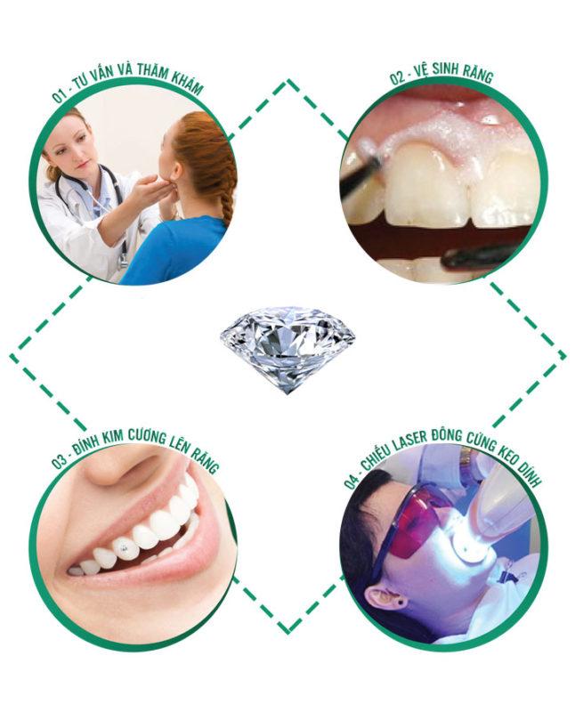 Quy trình đính đá lên răng tại Smile Up Dental Clinic