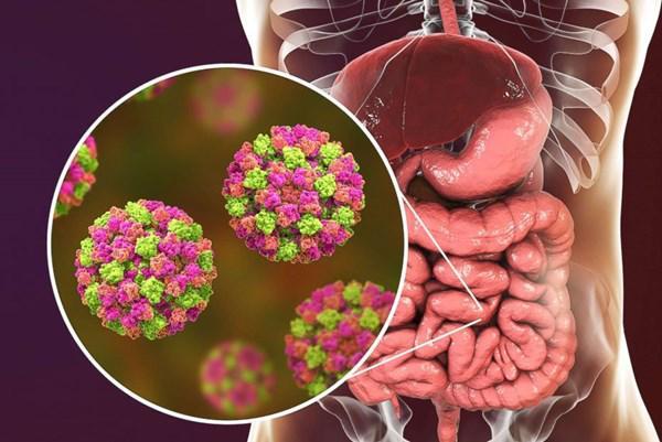 Norovirus là một loại virus dạ dày và ruột rất dễ lây lan trong mùa đông