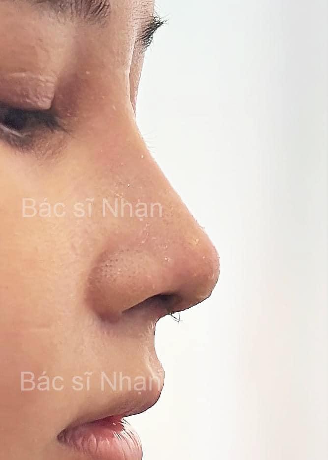 Noselab - Phòng khám chuyên sâu nâng mũi