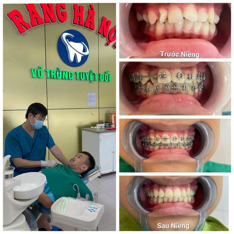Phòng khám răng Hà Nội
