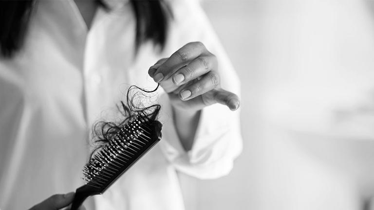 Rụng tóc là một triệu chứng gây nhiều rắc rối cho phụ nữ trong thời kỳ mãn kinh.
