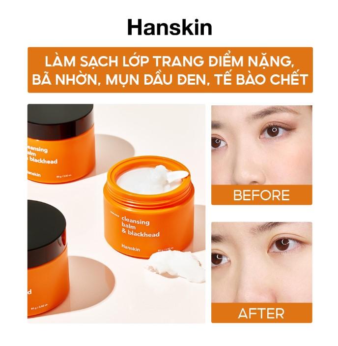 Sáp tẩy trang Hanskin Pore Cleansing Balm Aha