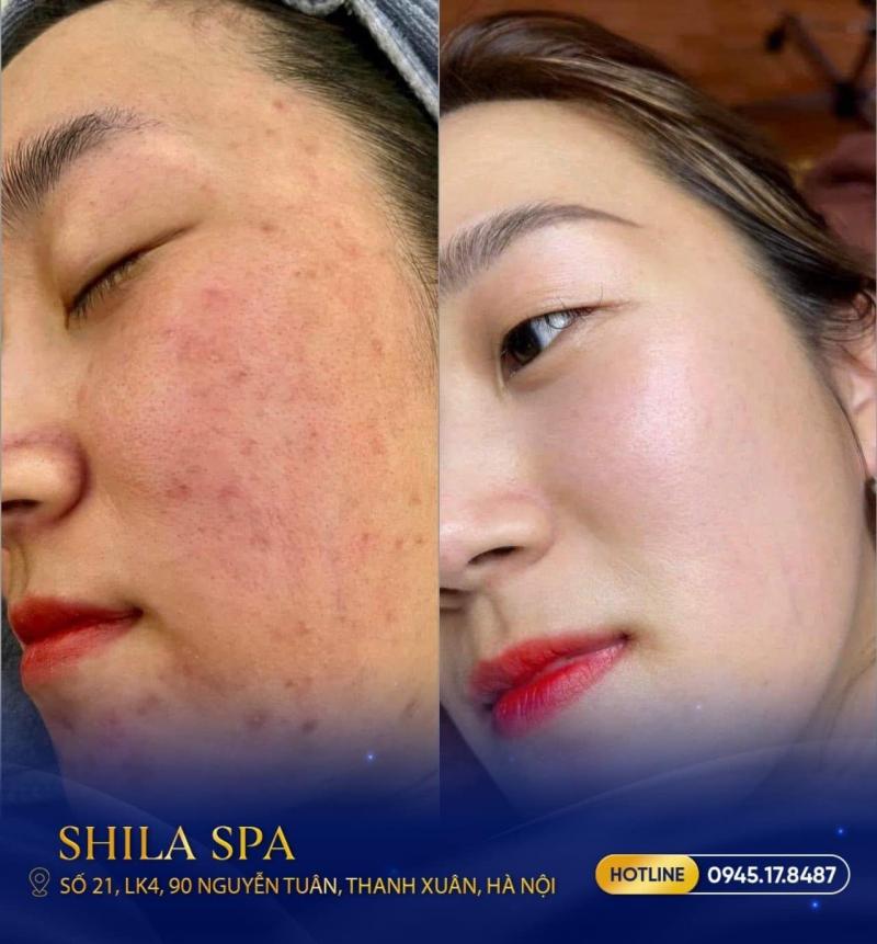 Shila Spa & Massage