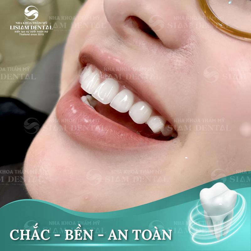 Siam Dental chi nhánh Hồ Chí Minh