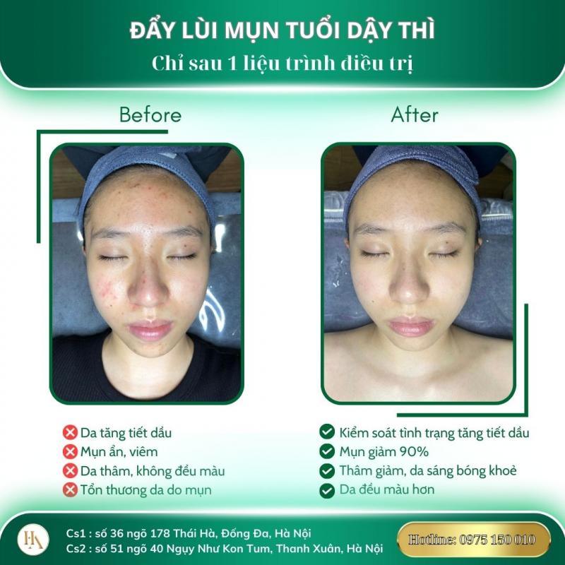 Spa Hải Anh