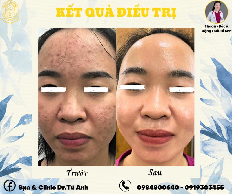 Spa&Clinic by Dr.Tú Anh