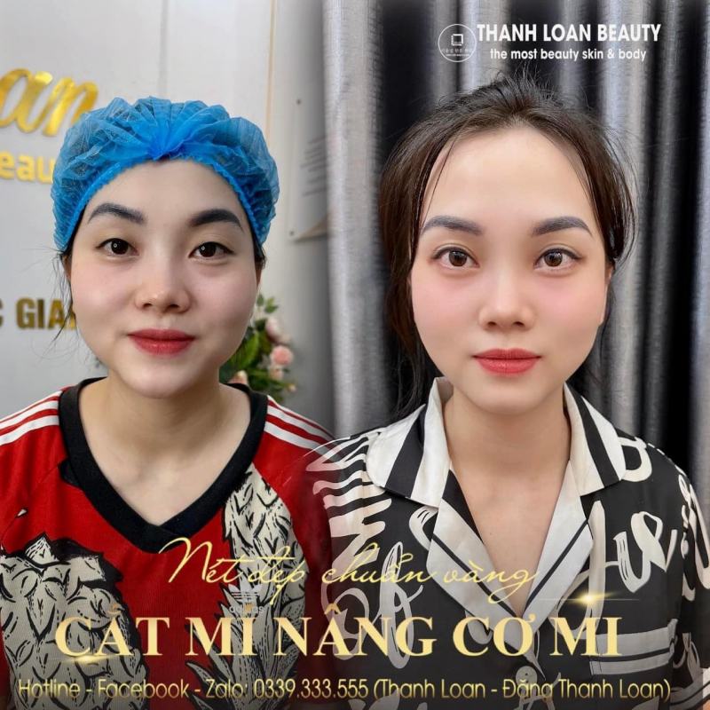 Thẩm Mỹ Thanh Loan Beauty Center