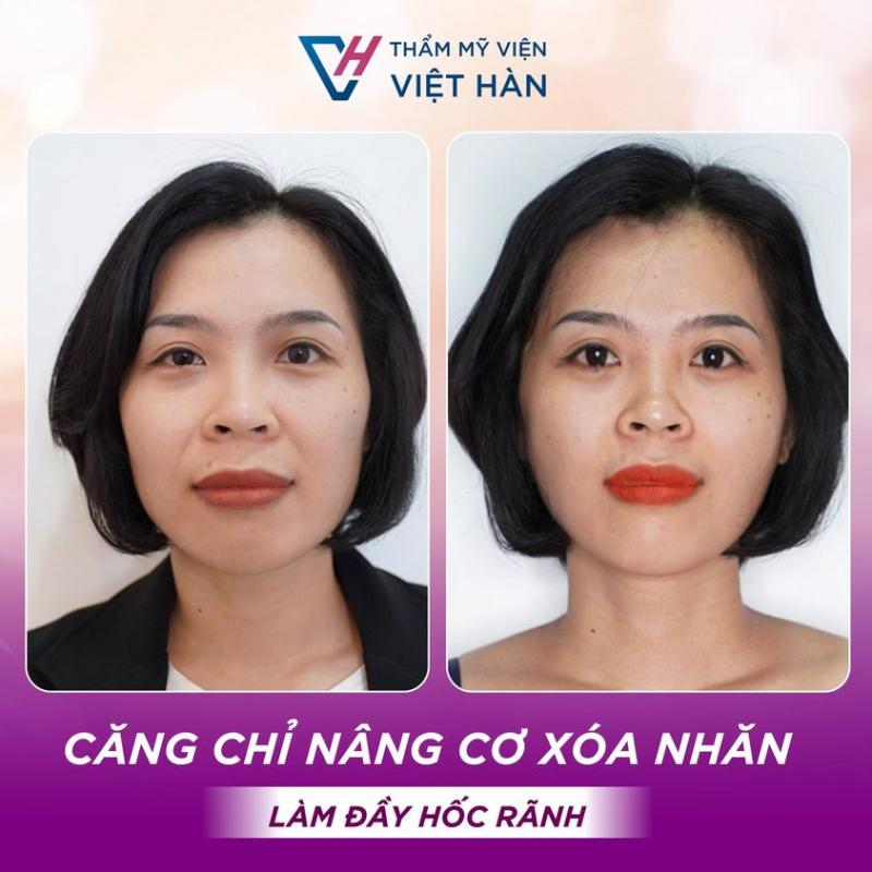 Thẩm Mỹ Viện Việt Hàn
