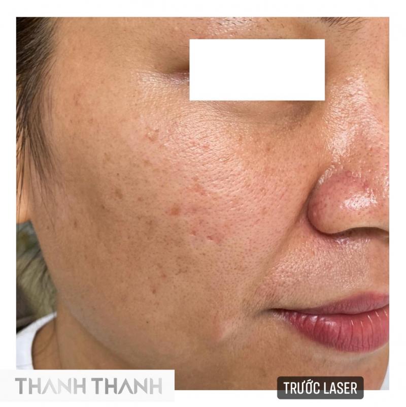 Thanh Thanh Spa - Skincare & Institute