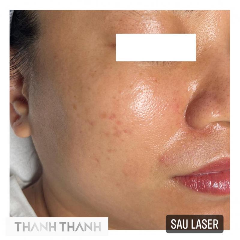 Thanh Thanh Spa - Skincare & Institute