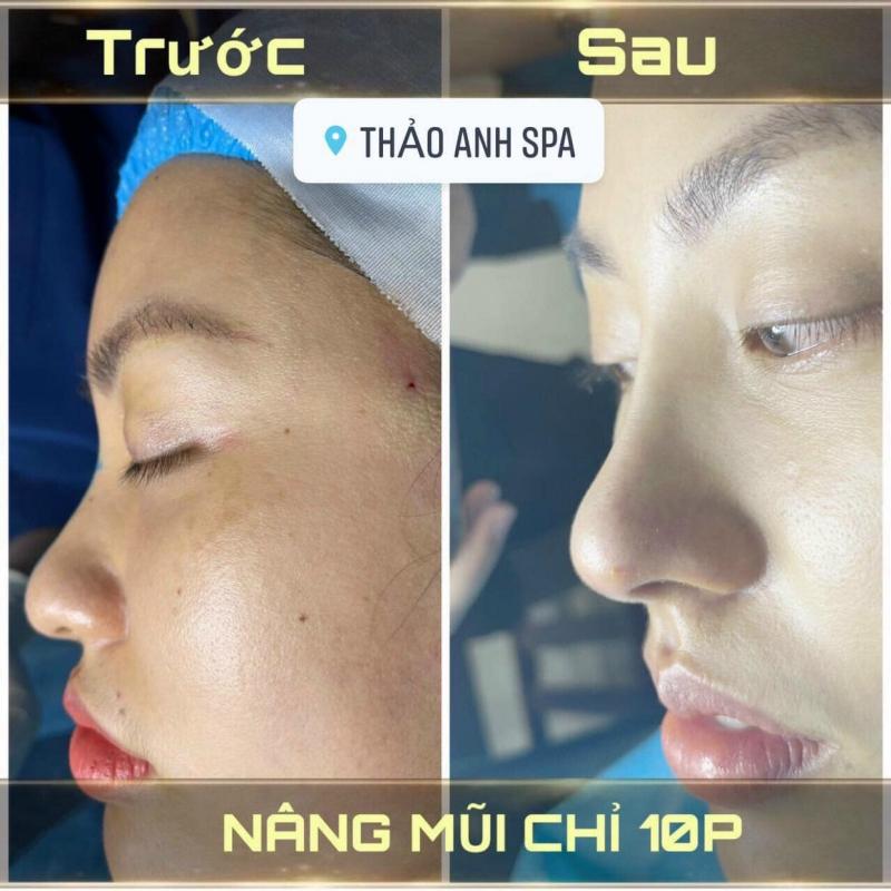 Thảo Anh Spa